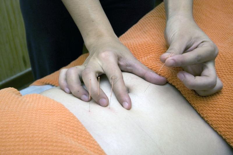 osteopathe-FAYENCE-min_acupuncture-4175625